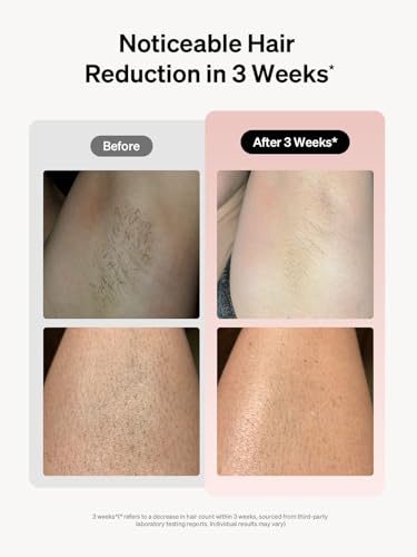 ?Nair Body Cream: Hair Remover? - Image 4