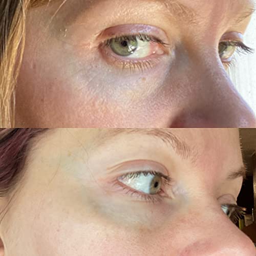 True Botanicals Eye Cream for Radiant Skin - Image 6