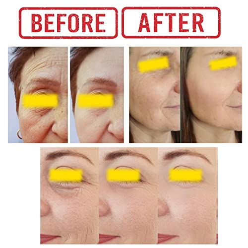Vitamin C Serum for Under Eye Circles - Image 4