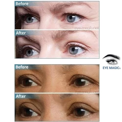TV?s Magic Eye Cream for reducing wrinkles and dark circles. - Image 6