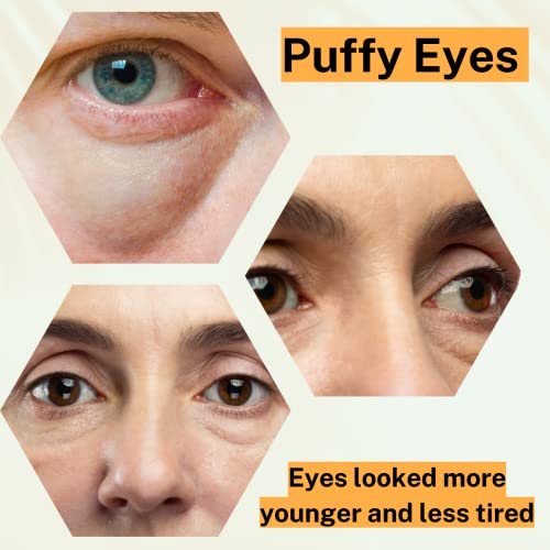 Vitamin C Serum for Under Eye Circles - Image 3
