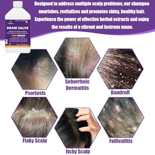 Natural anti-dandruff shampoo for healthy hair. - Image 2