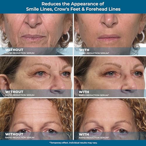 Dark Eye Cream for Under Eye Circles - Image 5