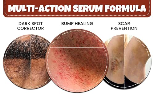 ?Whish Ingrown Hair Serum: Flawless Solution? - Image 5