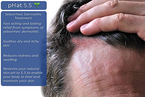 ?Candid Dandruff Shampoo? - Image 6