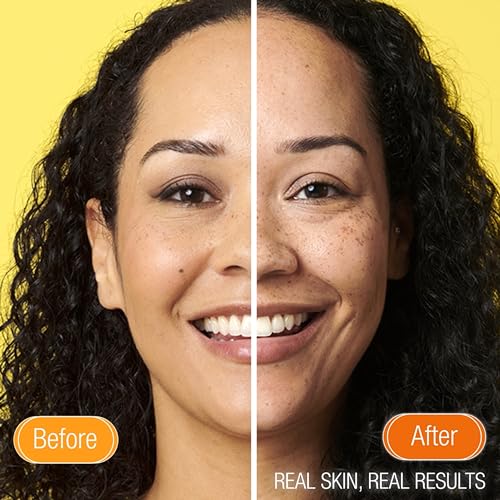 Vitamin C Eye Cream by Super Facialist - Image 4