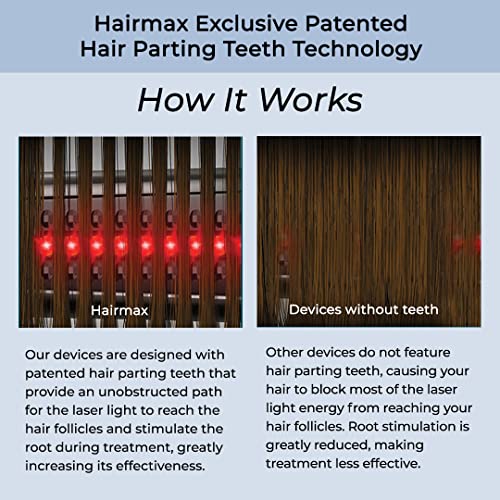 Ergonomic Laser Hair Growth Brush for Thinning Hair Gentle Bristles 100 Count - Image 8