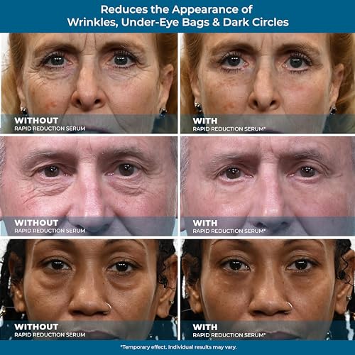 Dark Eye Cream for Under Eye Circles - Image 4