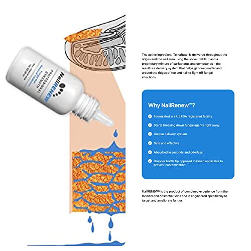 Chigger Bite Treatment with Nail Polish - Image 3