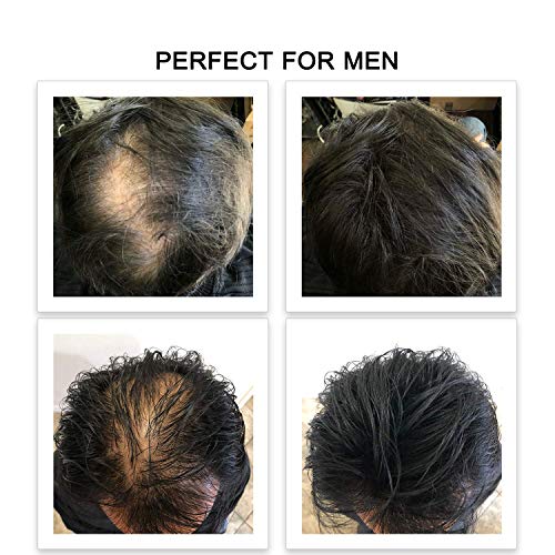 ?Blocking DHT Spray for Hair Loss? - Image 5