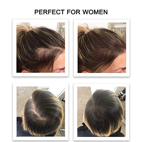 ?Blocking DHT Spray for Hair Loss? - Image 4
