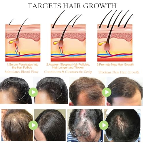 Cruelty-Free Hair Oils - Image 7