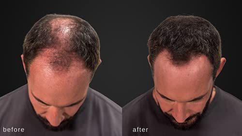Dermatologist-approved hair spray for healthy hair. - Image 5