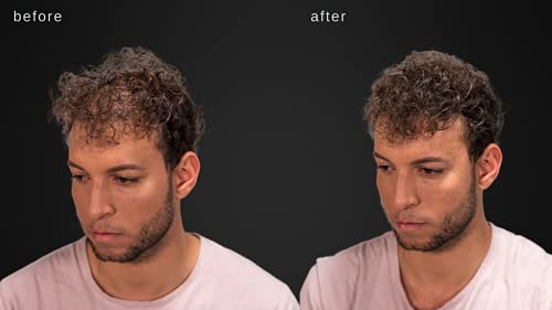 Dermatologist-approved hair spray for healthy hair. - Image 7