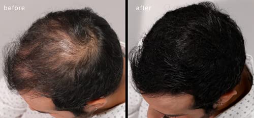 Dermatologist-approved hair spray for healthy hair. - Image 8