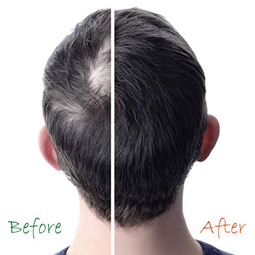 Doo Gro Leave In Conditioner ? Daily Hair Treatment - Image 3