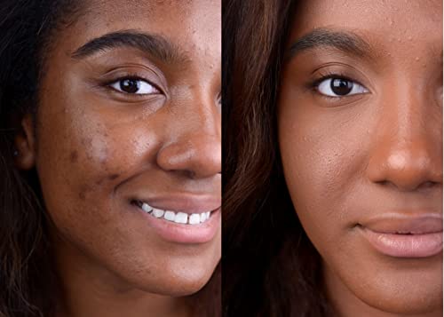 Hypoallergenic Gentle Foundation for Sensitive Skin Lightweight Formula 30ml Non-Irritating - Image 5