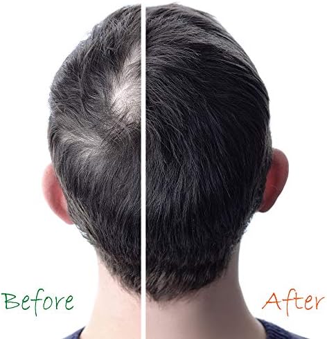 Hair cream blocks DHT to prevent hair loss. - Image 7