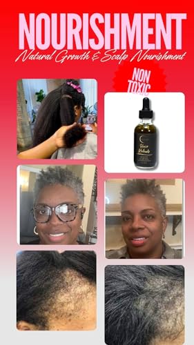 ?Keva Hair Oil: Natural and Nourishing? - Image 3