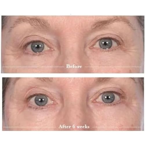 Lavido Eye Cream for Alertness and Brightening - Image 5