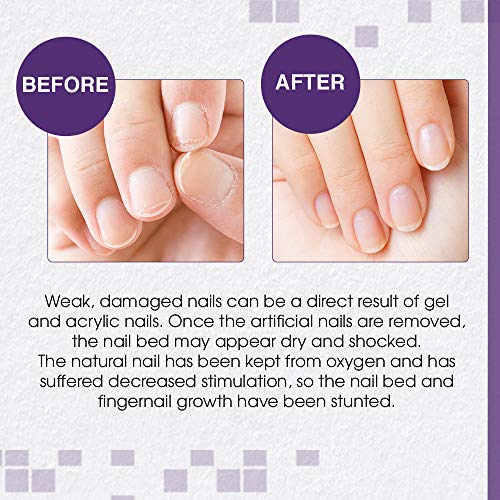 Nail Polish Damages Nails - Image 4