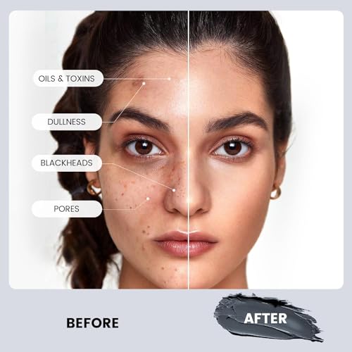 Nourishing Dead Sea Hair Mask for Healthy Hair - Image 4