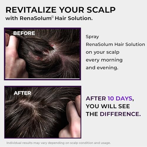 Spray for controlling dandruff in hair. - Image 3