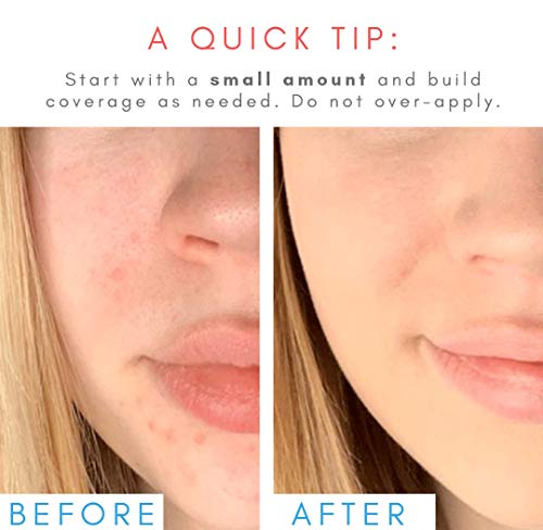 ?Sugar Foundation Stick: Ace Of Face? - Image 6