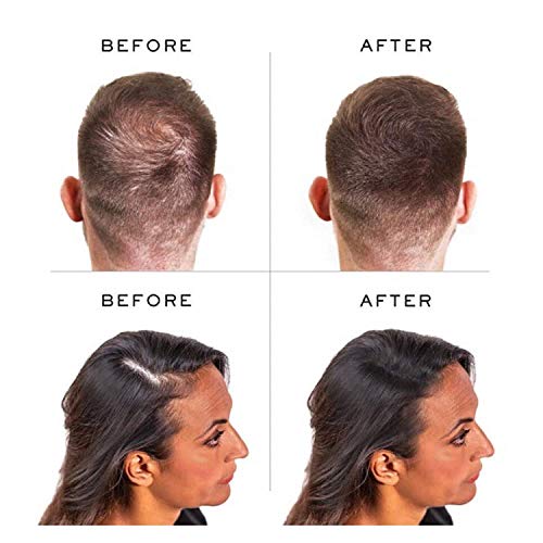 Thickening Hair Cream: Boost Volume and Thickness - Image 4