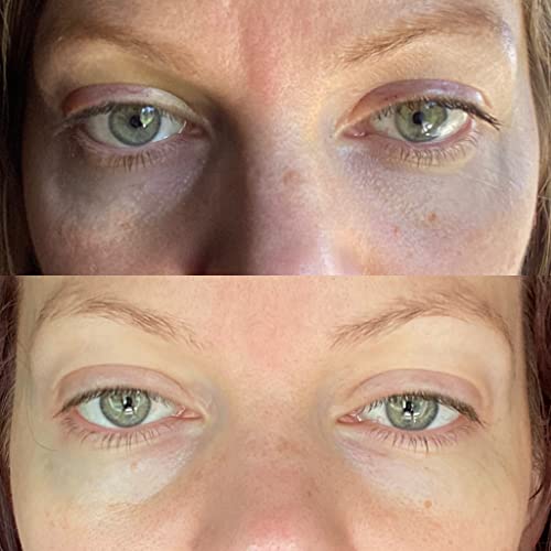 True Botanicals Eye Cream for Radiant Skin - Image 7