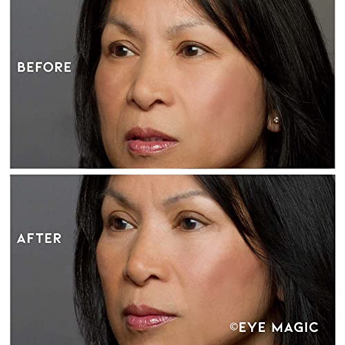 ?Verso Eye Cream: Reduces wrinkles and puffiness? - Image 9