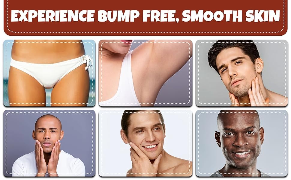 ?Whish Ingrown Hair Serum: Flawless Solution? - Image 6