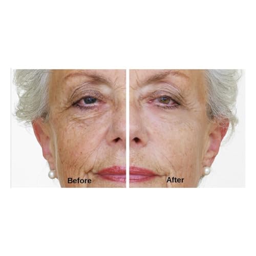 Retinol Eye Cream for Daily Use, 0.5 oz, All Skin Types Gentle Formula - Image 5