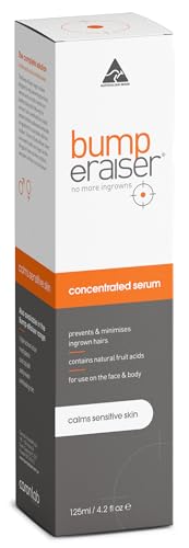 Prevent Ingrown Hairs Post-Waxing - Image 2