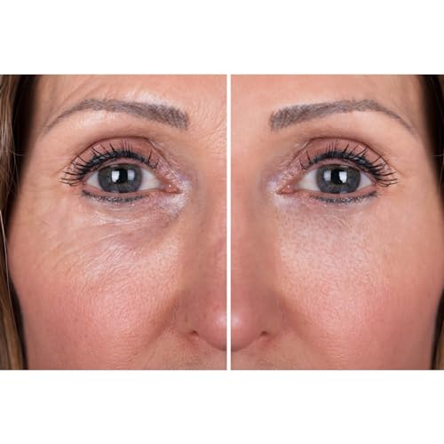 Retinol Eye Cream for Daily Use, 0.5 oz, All Skin Types Gentle Formula - Image 3