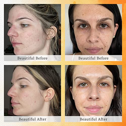 Niacinamide Eye Cream with Fabulous Benefits - Image 2