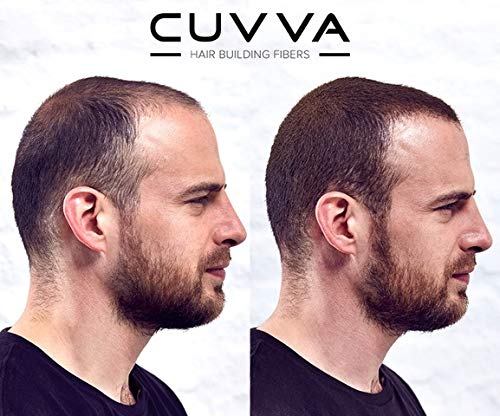 Baldness Covered by Hair Spray - Image 2