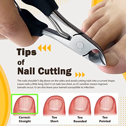 Clean nail clippers with rubbing alcohol. - Image 2