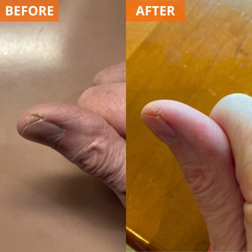Eczema eye cream for soothing relief. - Image 3
