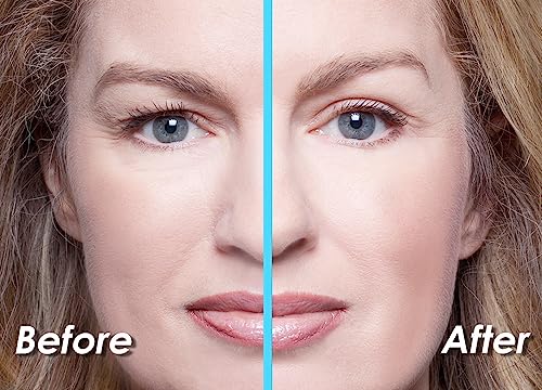 Firming and Hydrating Eye Cream by Lumene - Image 2