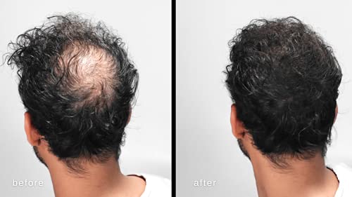 Hair Loss Cover-Up Spray - Image 2