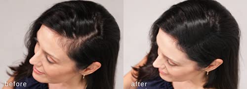 Hair Loss Cover-Up Spray - Image 3
