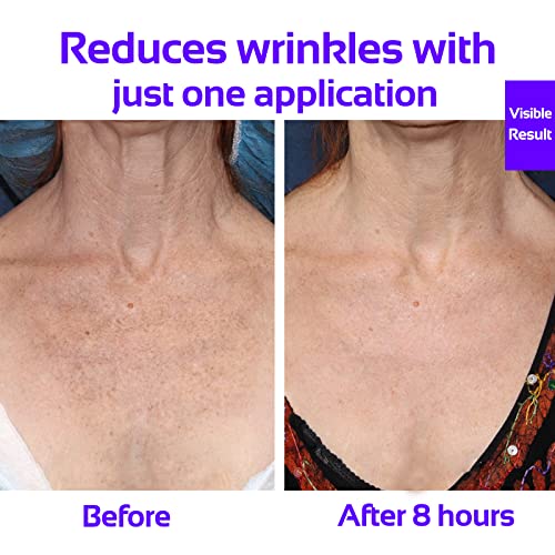 Liftstick: Wrinkle-reducing skincare solution. - Image 4