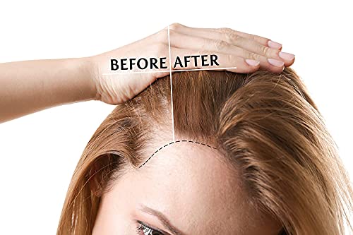 ?Natural Hair Oil for Transitioning? - Image 4