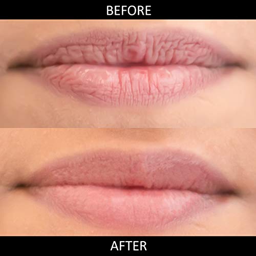 Organic Lip & Eye Cream by The Organic Pharmacy - Image 3