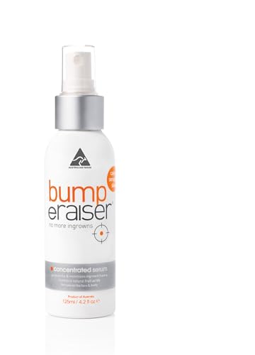 Prevent Ingrown Hairs Post-Waxing