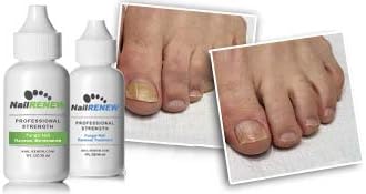 Eucalyptus Oil 30ml Natural Fungal Nail Treatment for Healthier Nails - Image 2