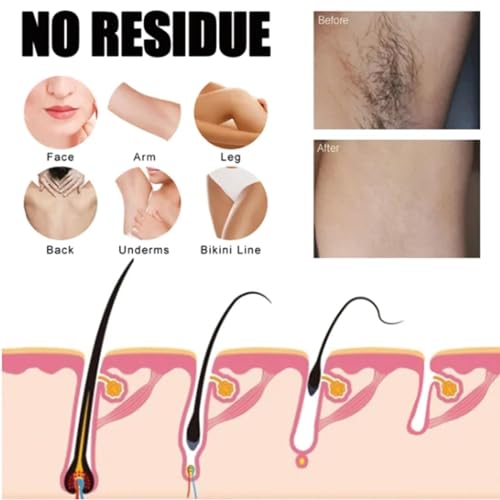 Hair Removal Cream, Smooth Hair Removal Cream Spray, Hair Removal Spray for Women and Men, Hair Removal Cream Spray, (Color : Men, Size : 1pcs) - Image 3