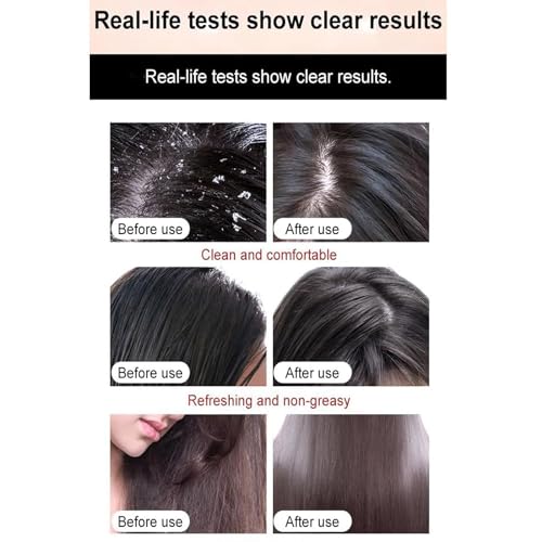Silicone-Free Anti-Dandruff Shampoo for Healthy Scalp 12 oz Bottle - Image 3