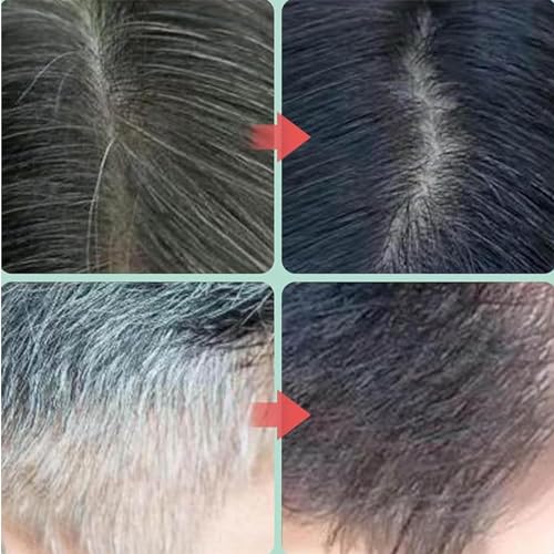 Tikieta Hair Dye, Tikieta Plant Hair Dye Shampoo, Plant Bubble Hair Dye Shampoo,Plant Extract Bubble Hair Color Shampoo, Natural Plant Hair Dye And Hair Care 2 In 1 (Chestnut Brown) - Image 6